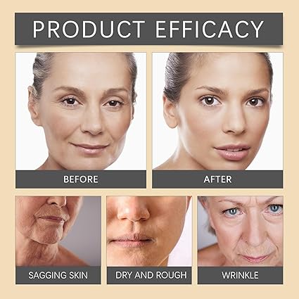 OUHOE Bee Venom Wrinkle Cream